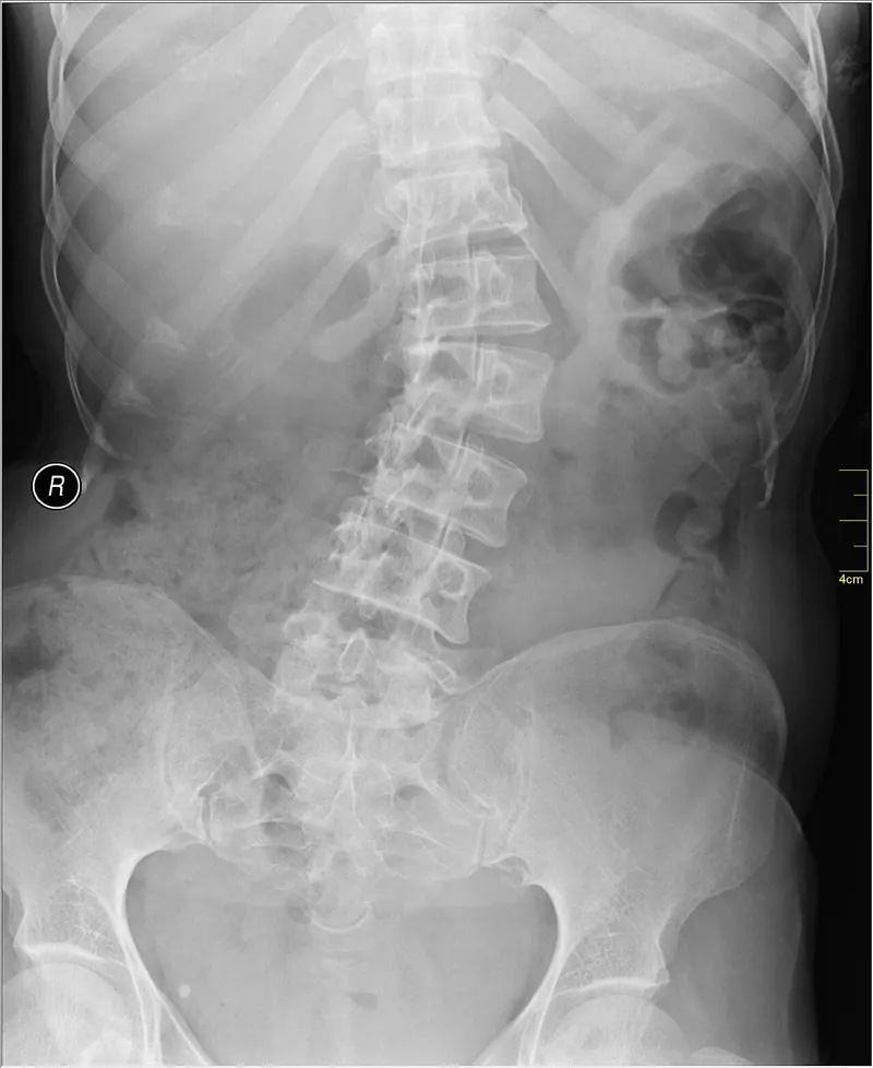 Ilustração da notícia: Cabeça curvada sobre o celular sobrecarrega o pescoço com cerca de 27 kg, diz médico